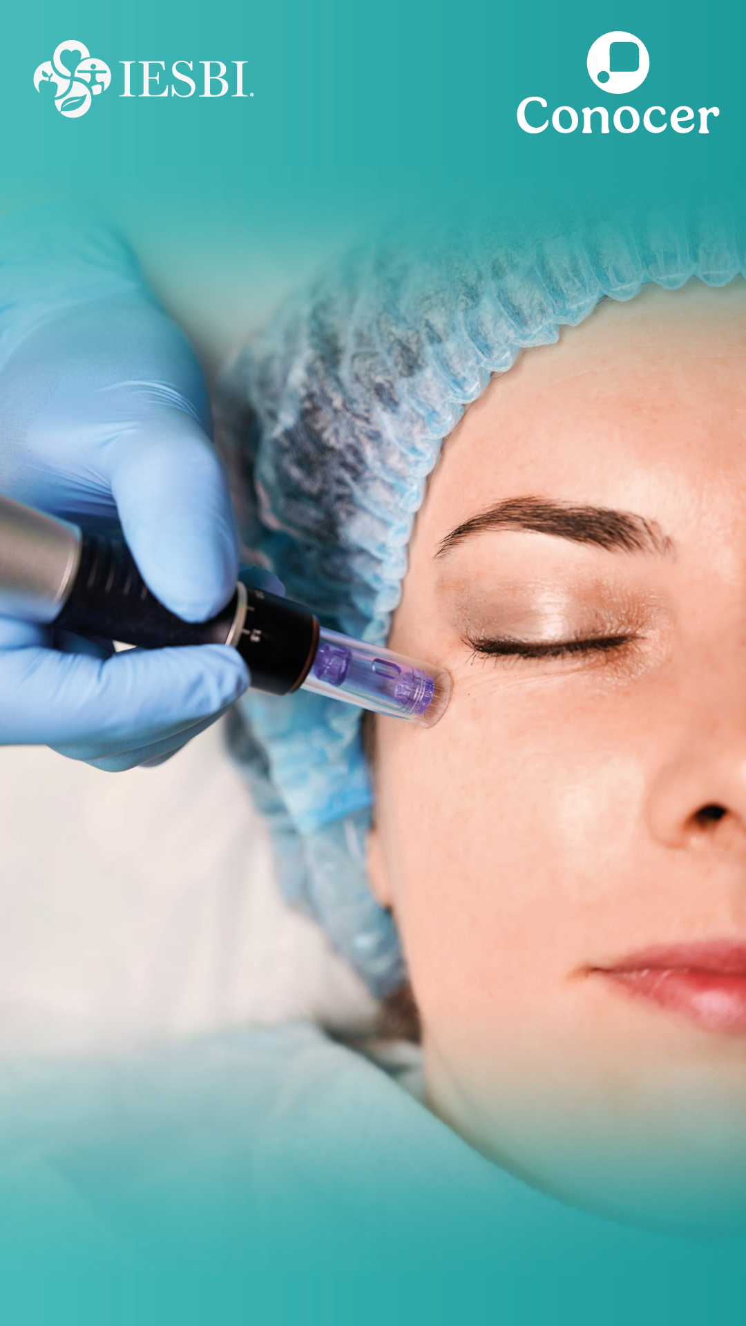 Aplicación de técnicas para el mejoramiento de la apariencia cutánea facial mediante dermapen